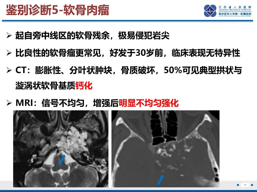 影像PPT - 【PPT】岩尖胆脂瘤-38
