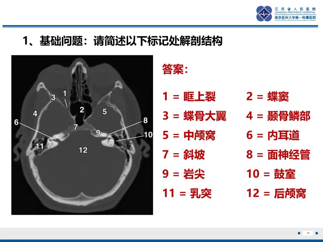 影像PPT - 【PPT】岩尖胆脂瘤-13