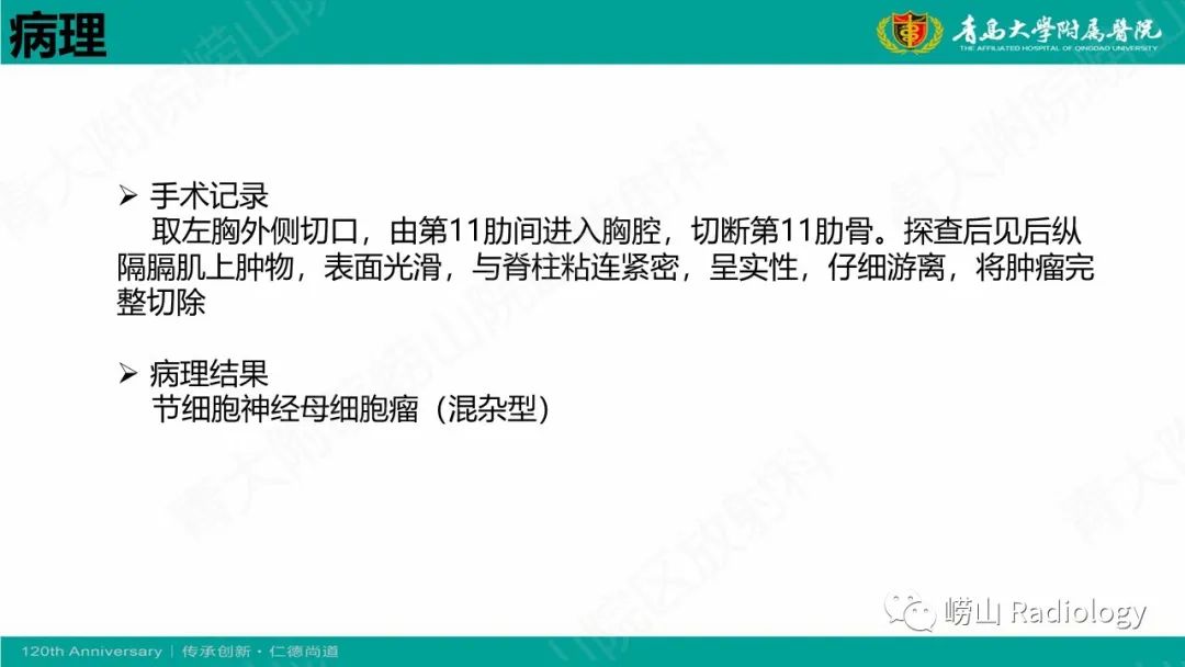 影像PPT - 【病例】腹膜后节细胞神经母细胞瘤1例CT影像-14