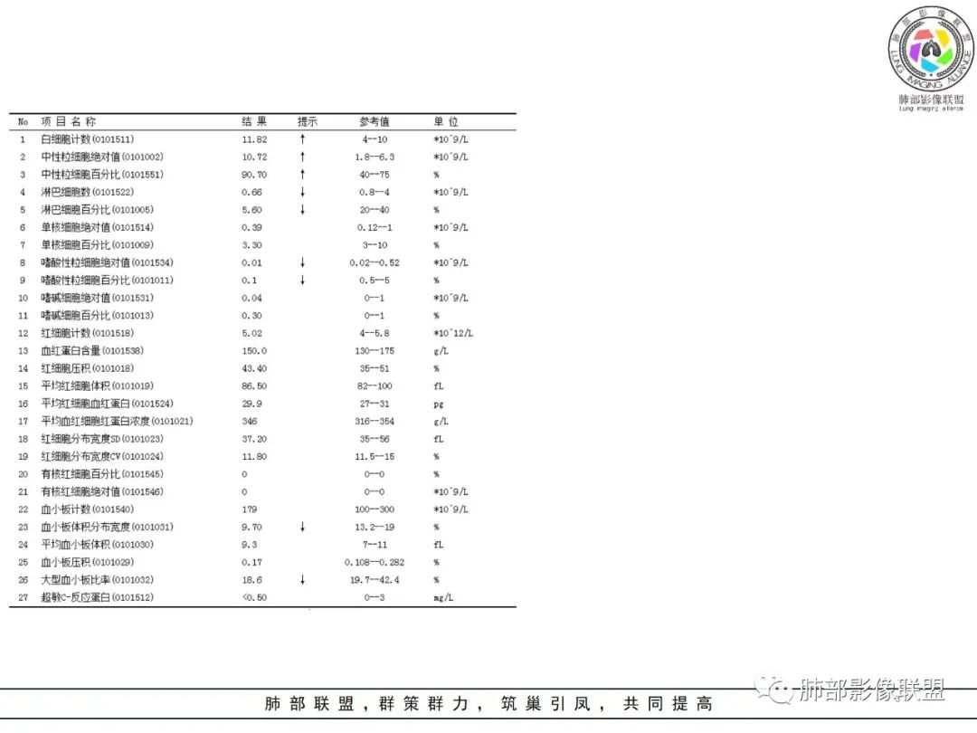 影像PPT - 【病例】肺大细胞神经内分泌癌1例CT影像-3 影像PPT - 【病例】肺大细胞神经内分泌癌1例CT影像-3
