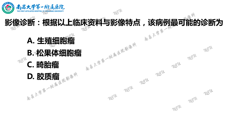 影像PPT - 【PPT】颅内生殖细胞瘤-7