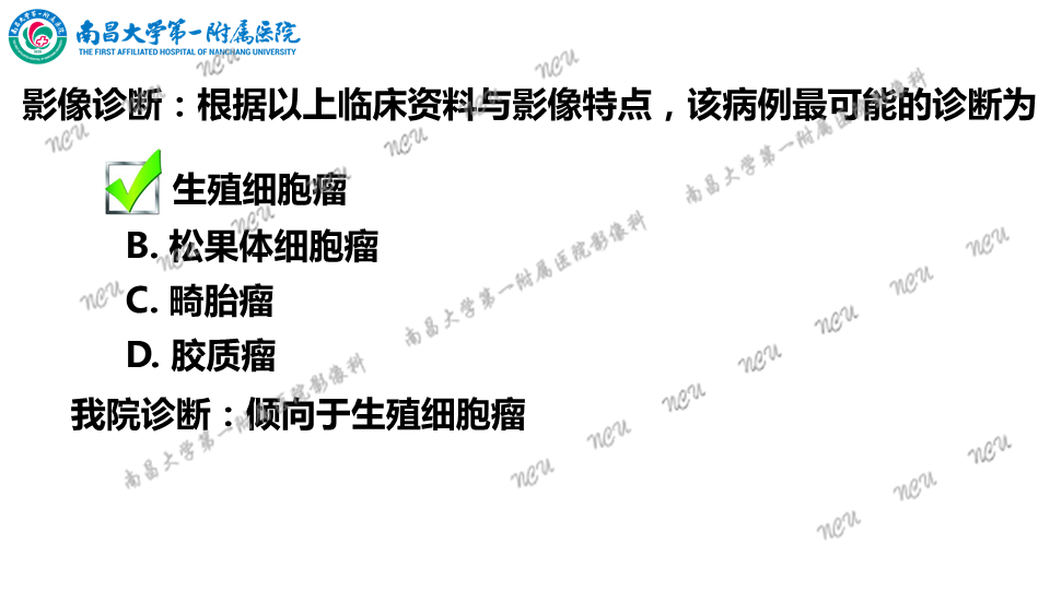 影像PPT - 【PPT】颅内生殖细胞瘤-8