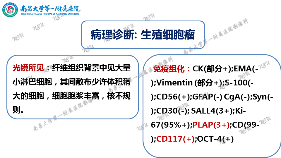 影像PPT - 【PPT】颅内生殖细胞瘤-9
