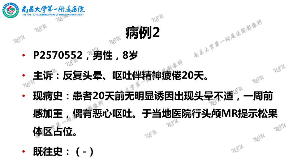 影像PPT - 【PPT】颅内生殖细胞瘤-10