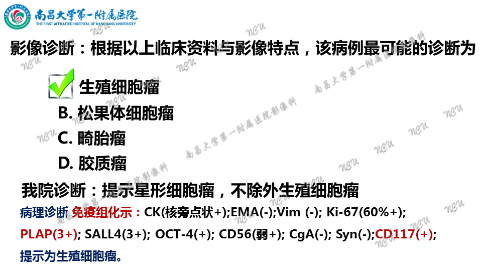 影像PPT - 【PPT】颅内生殖细胞瘤-14