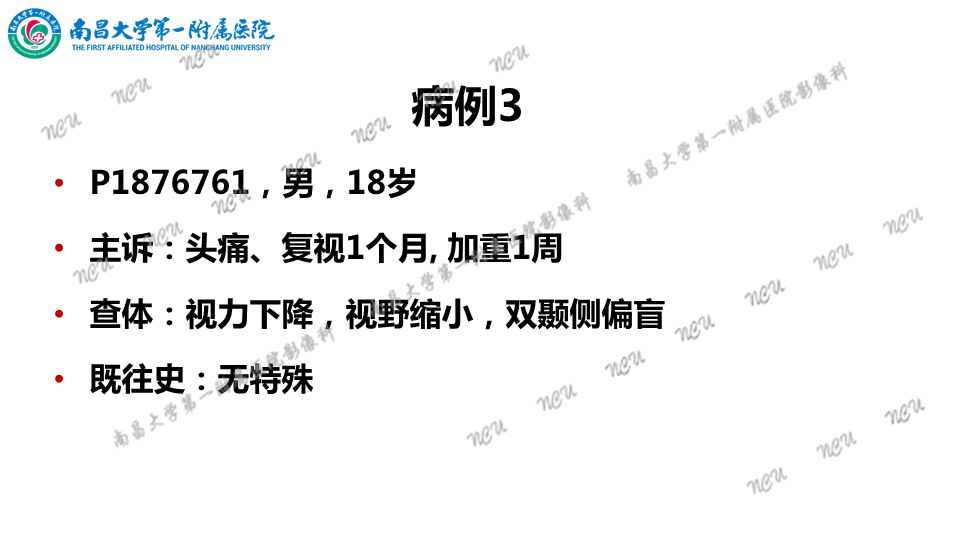 影像PPT - 【PPT】颅内生殖细胞瘤-15