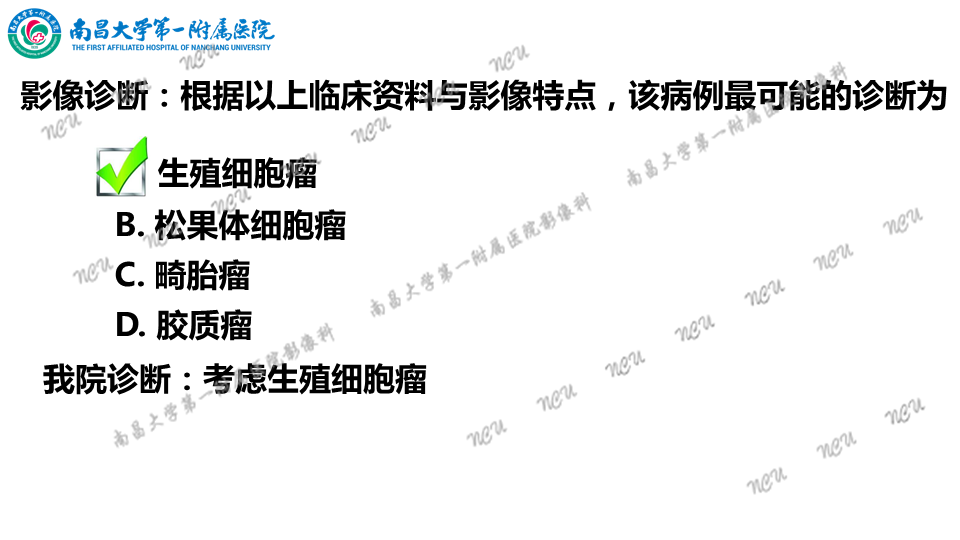 影像PPT - 【PPT】颅内生殖细胞瘤-18