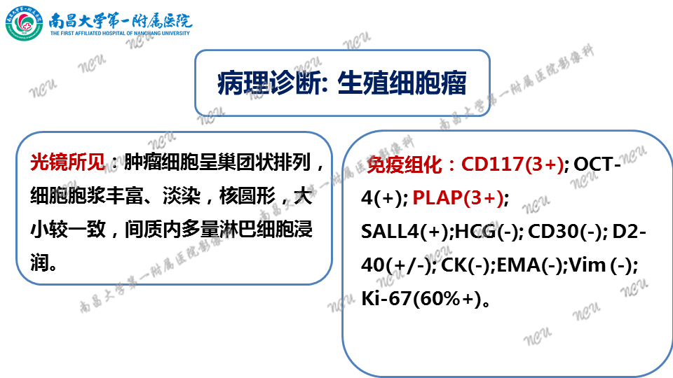 影像PPT - 【PPT】颅内生殖细胞瘤-19