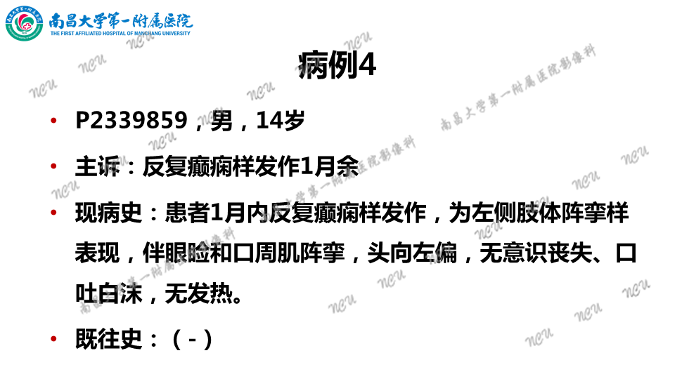 影像PPT - 【PPT】颅内生殖细胞瘤-20