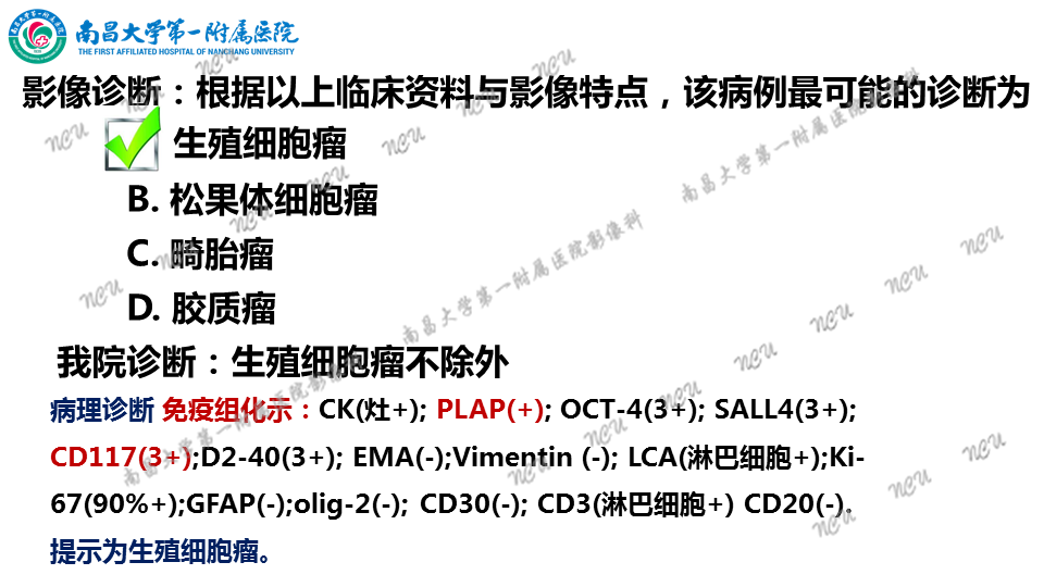 影像PPT - 【PPT】颅内生殖细胞瘤-25