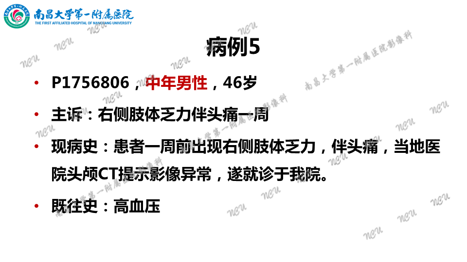 影像PPT - 【PPT】颅内生殖细胞瘤-26