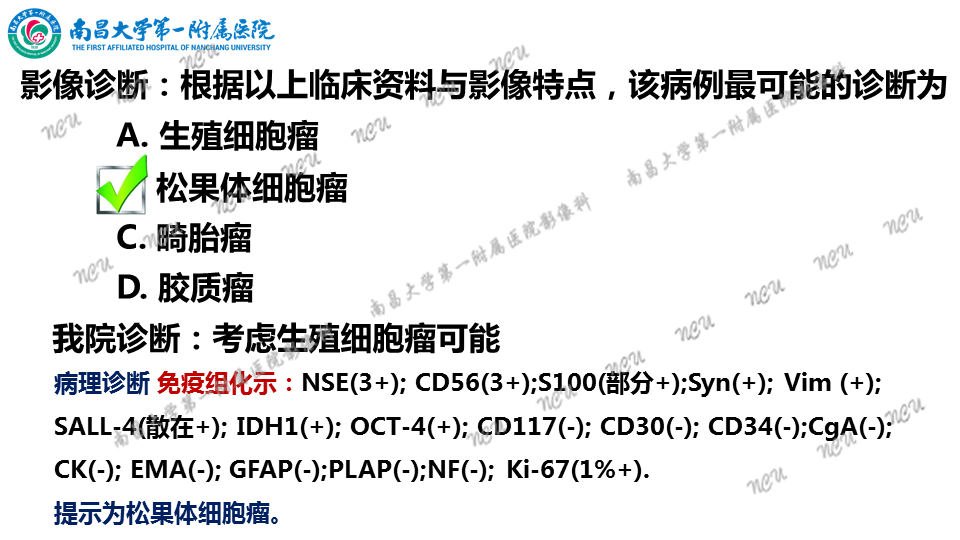 影像PPT - 【PPT】颅内生殖细胞瘤-30