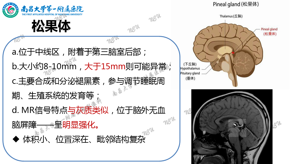 影像PPT - 【PPT】颅内生殖细胞瘤-38