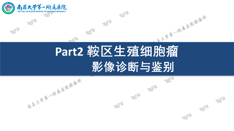 影像PPT - 【PPT】颅内生殖细胞瘤-48