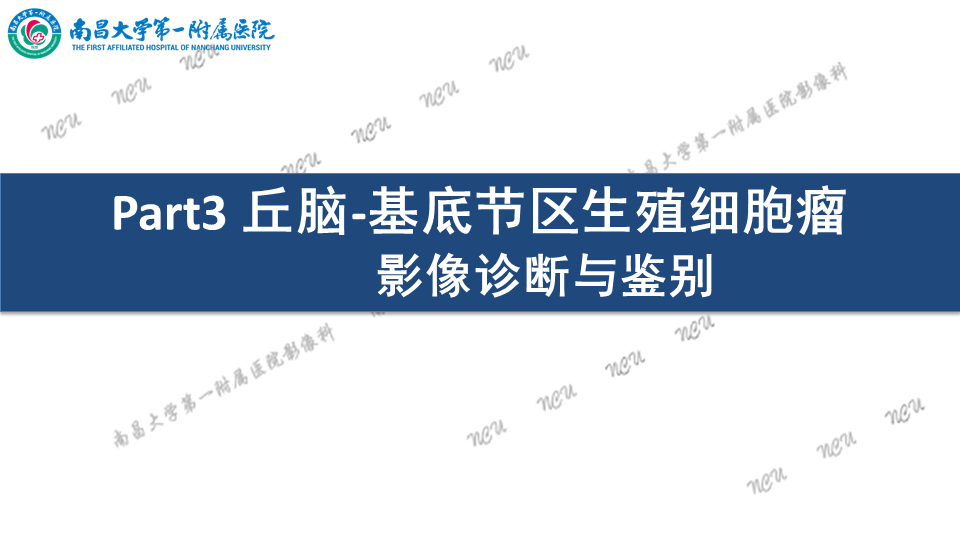 影像PPT - 【PPT】颅内生殖细胞瘤-53