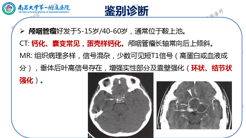 影像PPT - 【PPT】颅内生殖细胞瘤-50