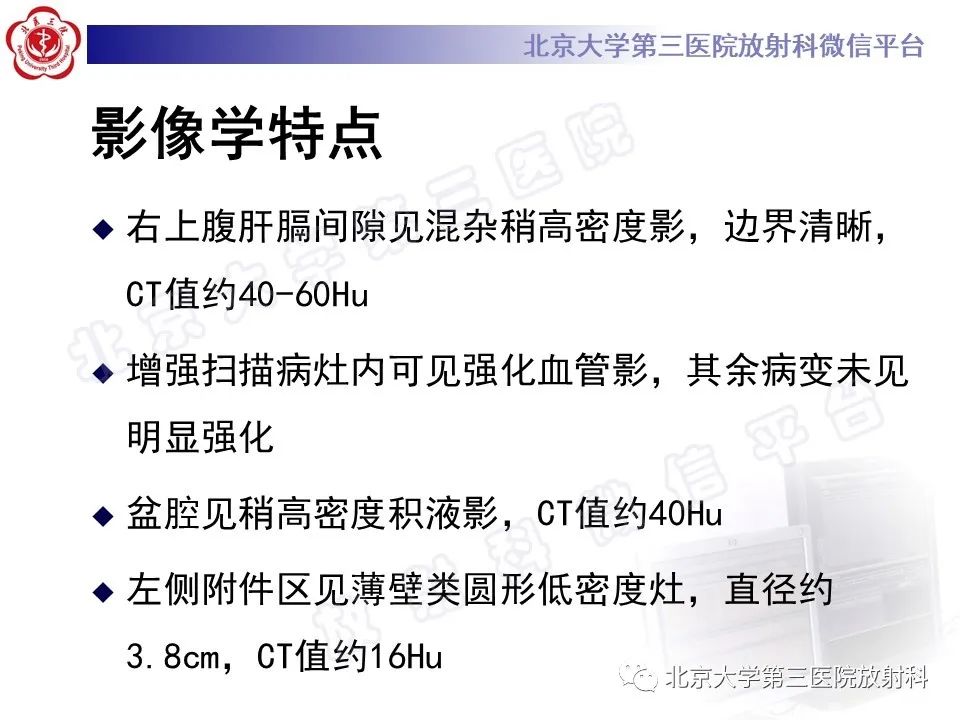 影像PPT - 【PPT】膈下异位妊娠-7