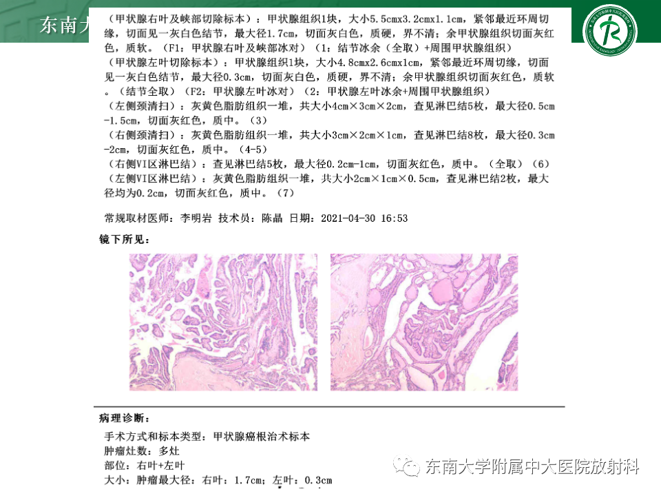 影像PPT - 【PPT】甲状腺癌的影像诊断-4