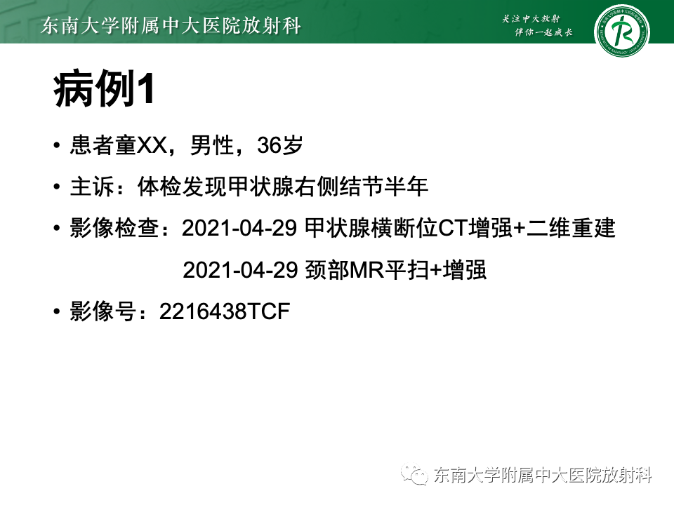 影像PPT - 【PPT】甲状腺癌的影像诊断-1