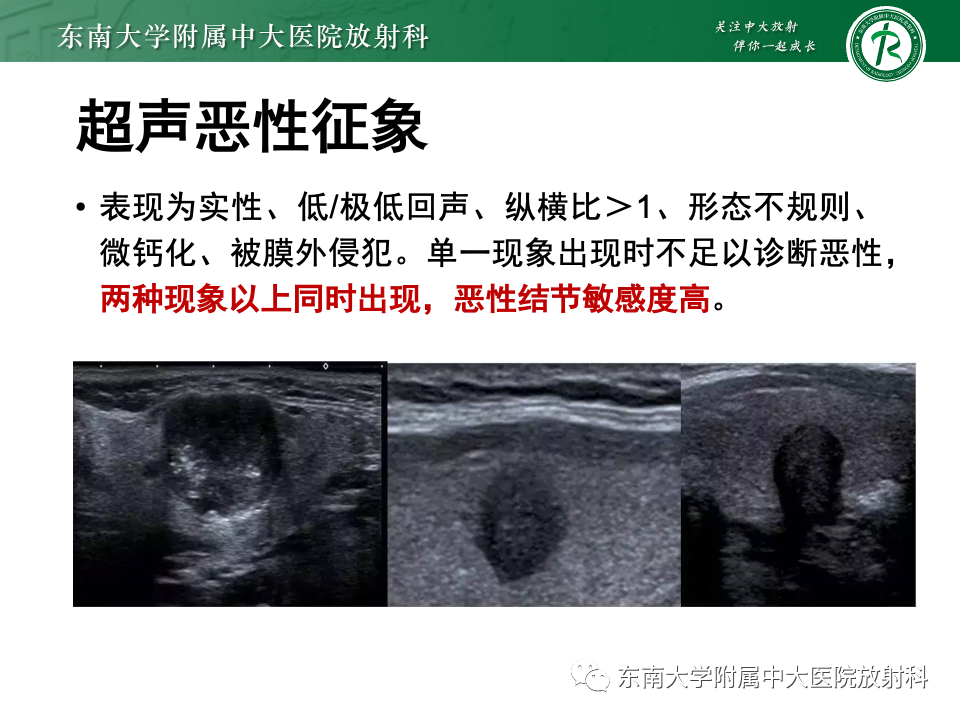 影像PPT - 【PPT】甲状腺癌的影像诊断-11