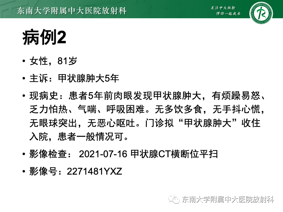 影像PPT - 【PPT】甲状腺癌的影像诊断-25