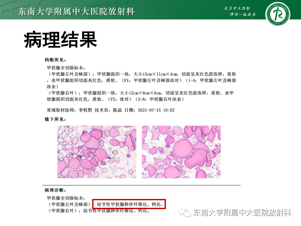 影像PPT - 【PPT】甲状腺癌的影像诊断-27
