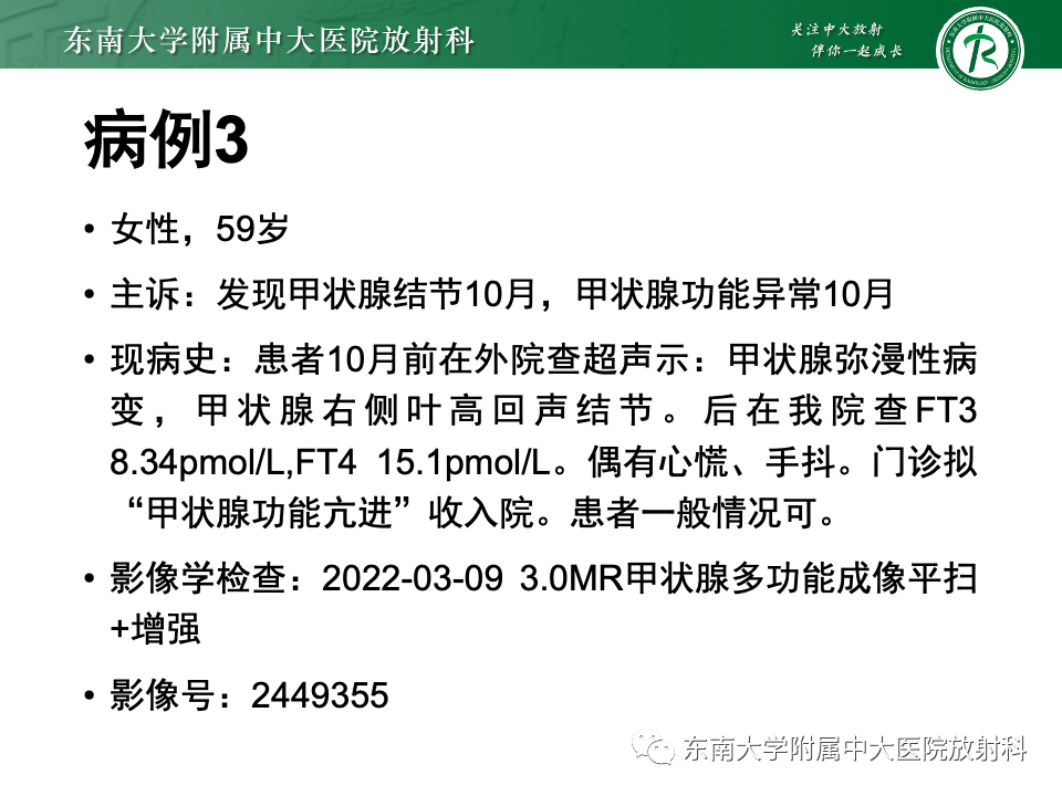 影像PPT - 【PPT】甲状腺癌的影像诊断-28