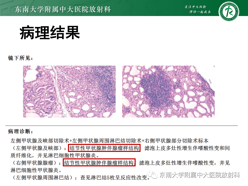 影像PPT - 【PPT】甲状腺癌的影像诊断-30