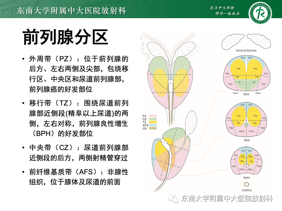影像PPT - 【PPT】理影外合——前列腺癌-2 影像PPT - 【PPT】理影外合——前列腺癌-2