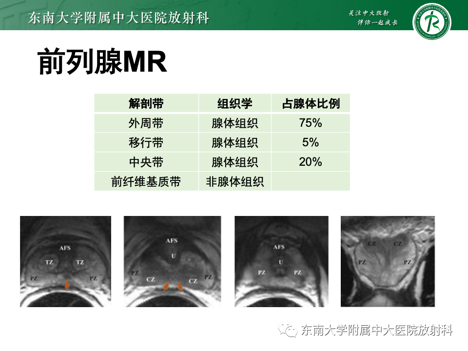 影像PPT - 【PPT】理影外合——前列腺癌-3 影像PPT - 【PPT】理影外合——前列腺癌-3