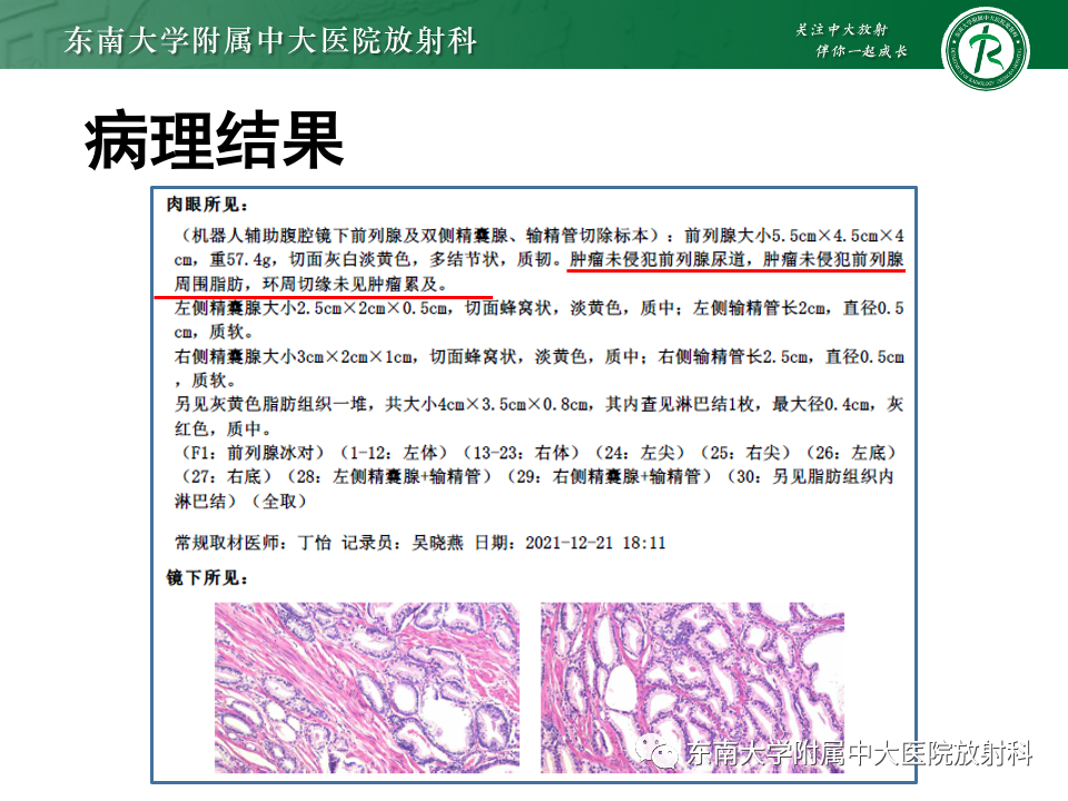 影像PPT - 【PPT】理影外合——前列腺癌-6 影像PPT - 【PPT】理影外合——前列腺癌-6