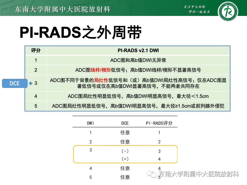 影像PPT - 【PPT】理影外合——前列腺癌-13 影像PPT - 【PPT】理影外合——前列腺癌-13