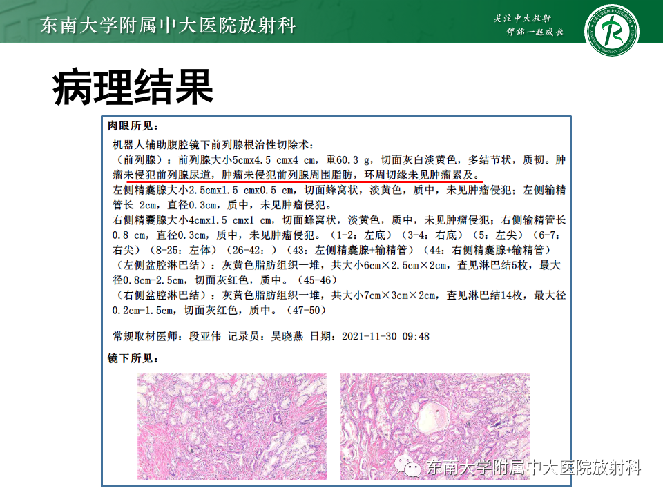 影像PPT - 【PPT】理影外合——前列腺癌-11 影像PPT - 【PPT】理影外合——前列腺癌-11