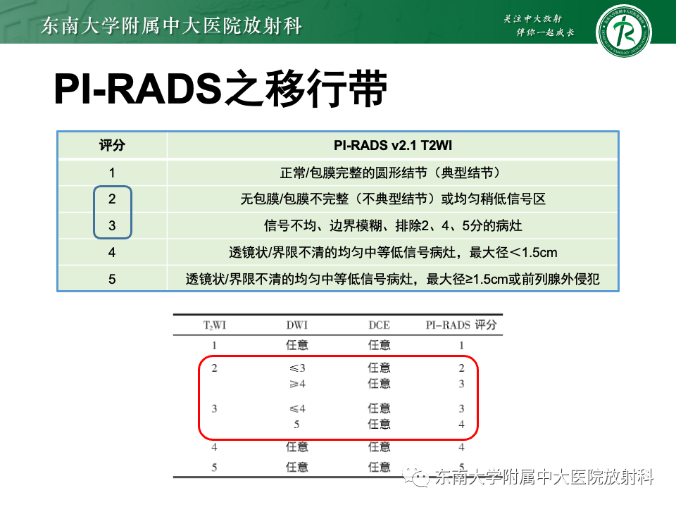 影像PPT - 【PPT】理影外合——前列腺癌-8 影像PPT - 【PPT】理影外合——前列腺癌-8