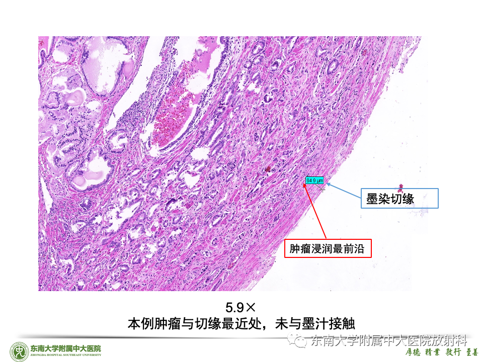 影像PPT - 【PPT】理影外合——前列腺癌-29 影像PPT - 【PPT】理影外合——前列腺癌-29