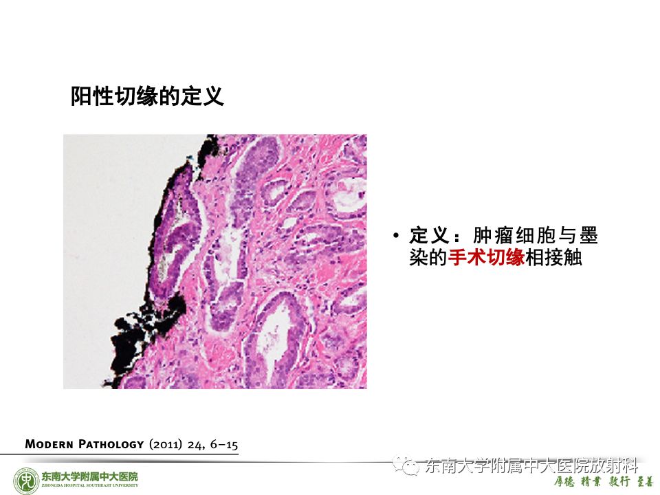 影像PPT - 【PPT】理影外合——前列腺癌-30 影像PPT - 【PPT】理影外合——前列腺癌-30