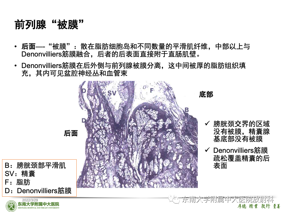 影像PPT - 【PPT】理影外合——前列腺癌-35 影像PPT - 【PPT】理影外合——前列腺癌-35