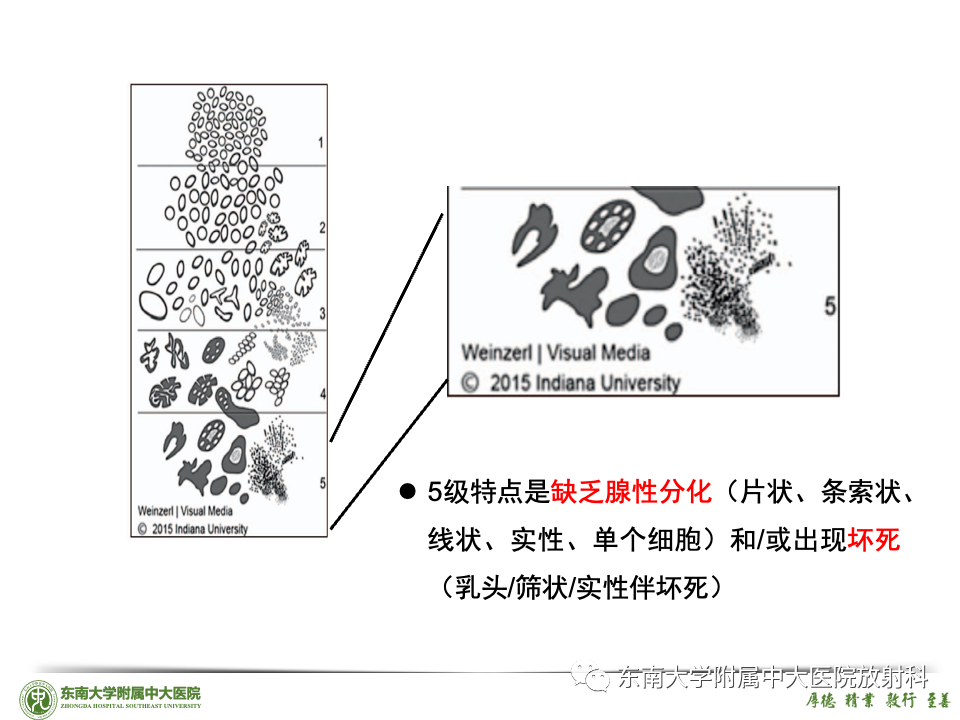 影像PPT - 【PPT】理影外合——前列腺癌-46 影像PPT - 【PPT】理影外合——前列腺癌-46