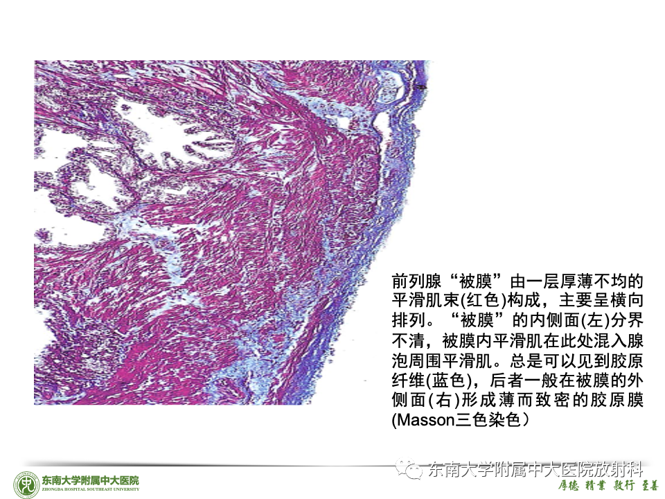 影像PPT - 【PPT】理影外合——前列腺癌-33 影像PPT - 【PPT】理影外合——前列腺癌-33
