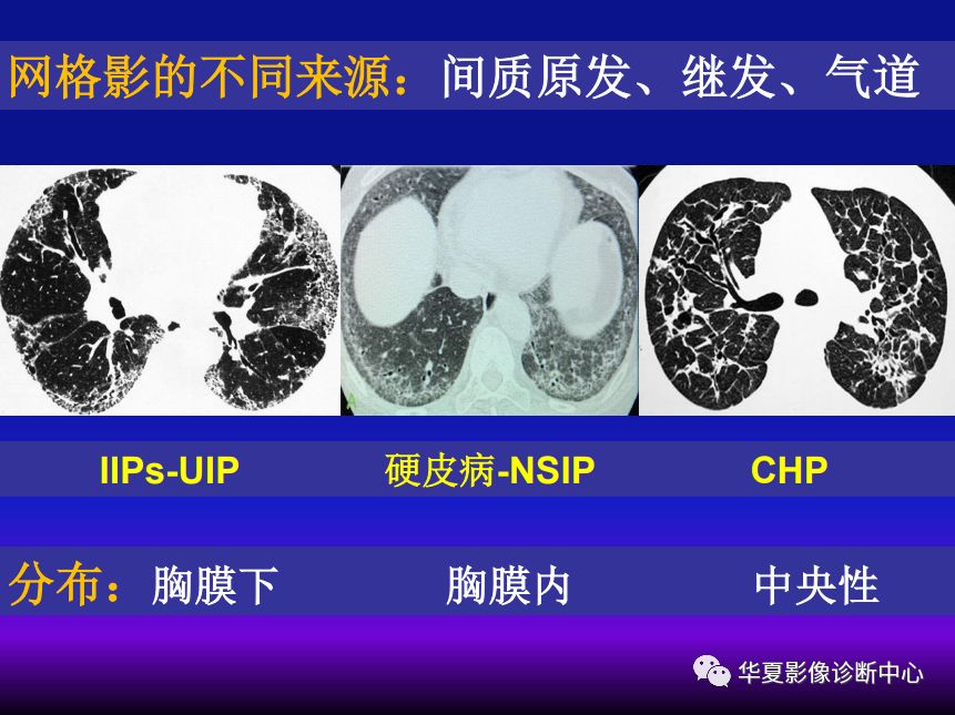 影像PPT - 【PPT】肺间质性疾病来源、解剖、病理和影像-8