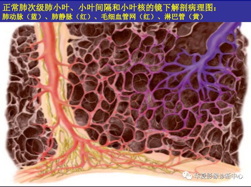 影像PPT - 【PPT】肺间质性疾病来源、解剖、病理和影像-34