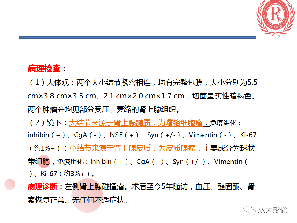 影像PPT - 【PPT】肾上腺碰撞瘤-5