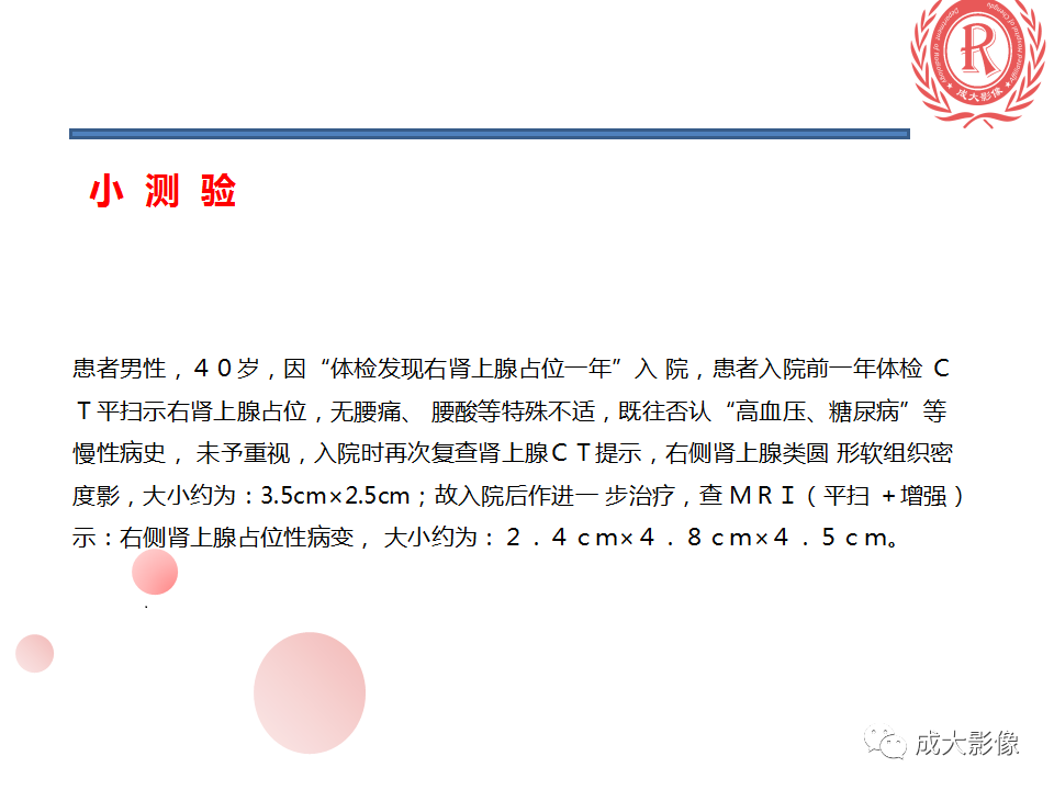 影像PPT - 【PPT】肾上腺碰撞瘤-21