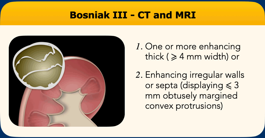 影像PPT - 肾囊性病变Bosniak分类-18 影像PPT - 肾囊性病变Bosniak分类-18