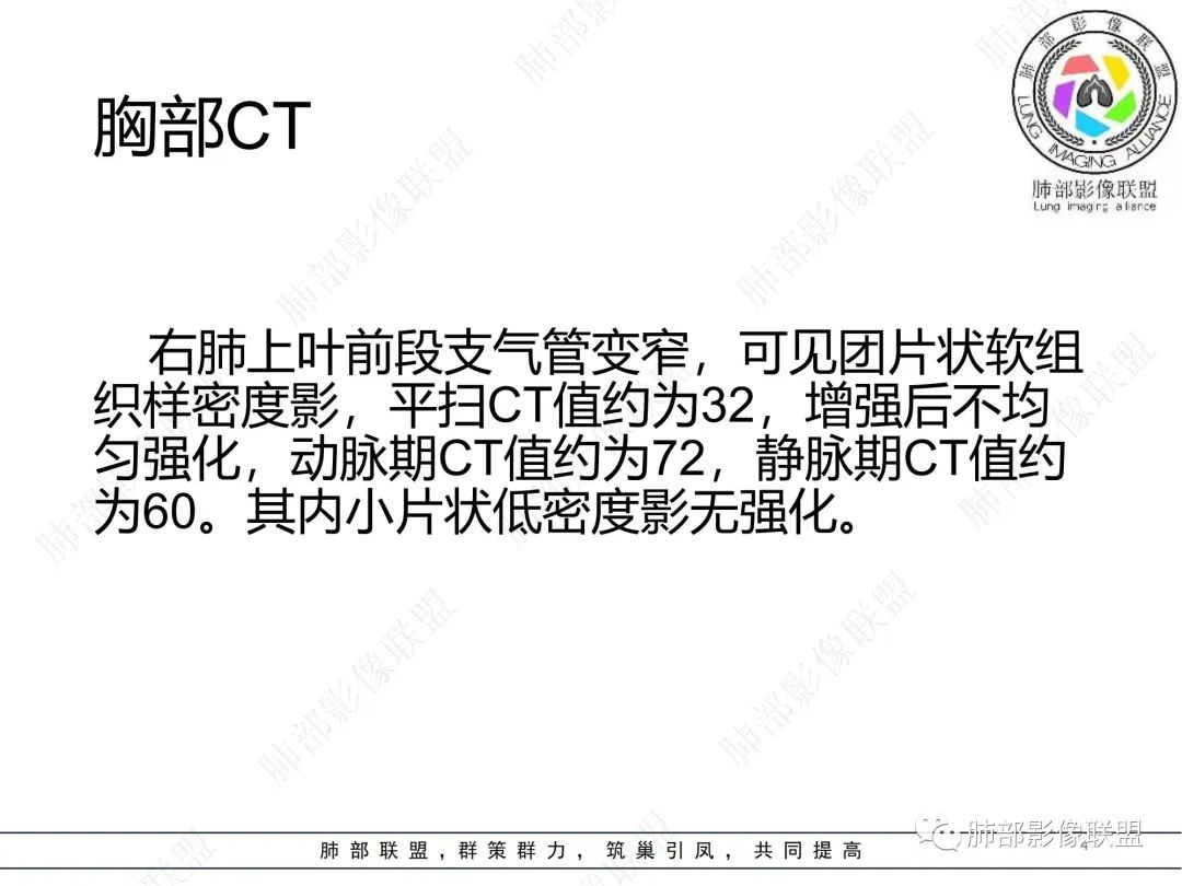 影像PPT - 【病例】 如此典型的支气管结核-4 影像PPT - 【病例】 如此典型的支气管结核-4