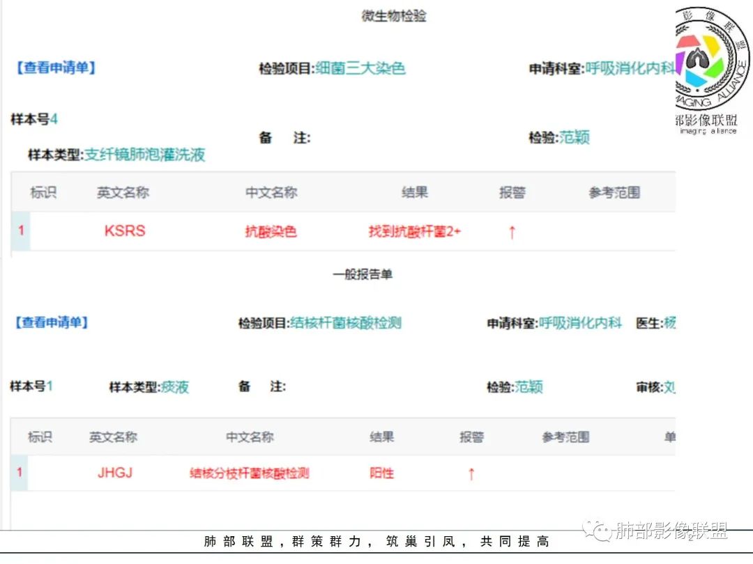 影像PPT - 【病例】 如此典型的支气管结核-54 影像PPT - 【病例】 如此典型的支气管结核-54