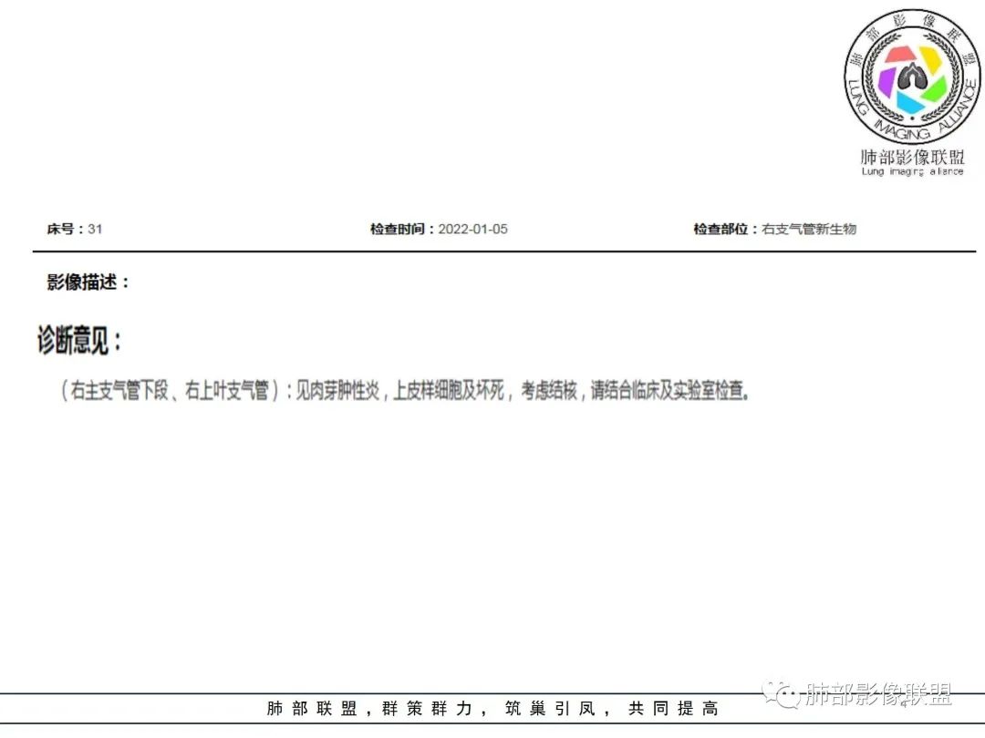 影像PPT - 【病例】 如此典型的支气管结核-56 影像PPT - 【病例】 如此典型的支气管结核-56