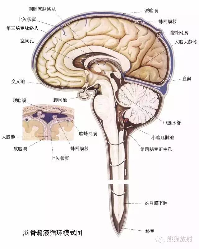 影像PPT - 【病例】巨大的蛛网膜颗粒1例MR-3 影像PPT - 【病例】巨大的蛛网膜颗粒1例MR-3