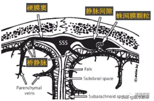 影像PPT - 【病例】巨大的蛛网膜颗粒1例MR-5 影像PPT - 【病例】巨大的蛛网膜颗粒1例MR-5
