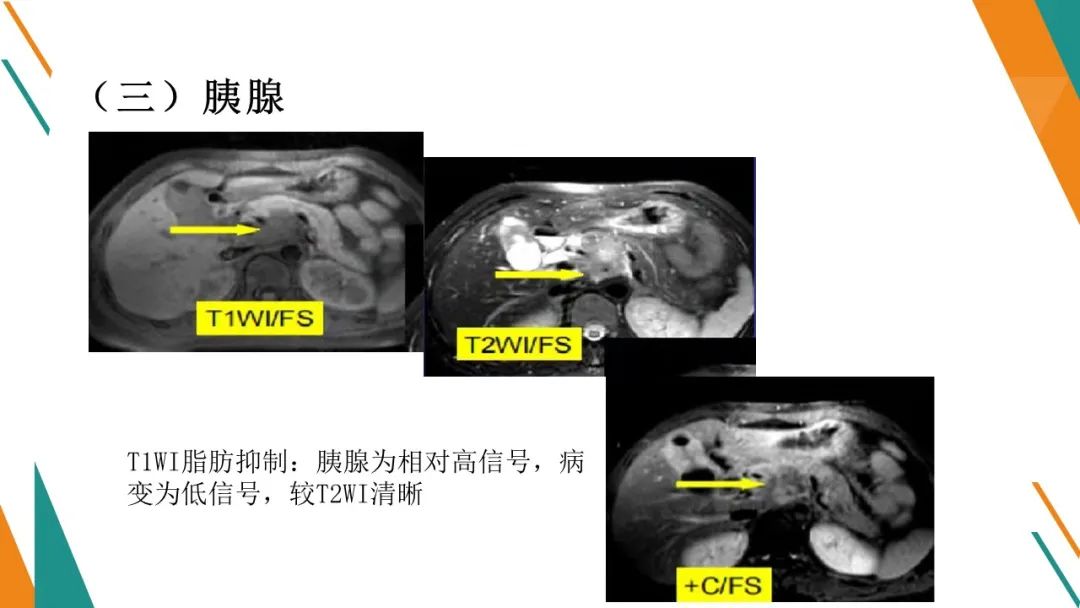 影像PPT - 【PPT】腹部MRI扫描、增强期相及延迟扫描策略-12